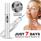 Blue Light Acne & Scar Treatment Pen