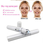 Blue Light Acne & Scar Treatment Pen
