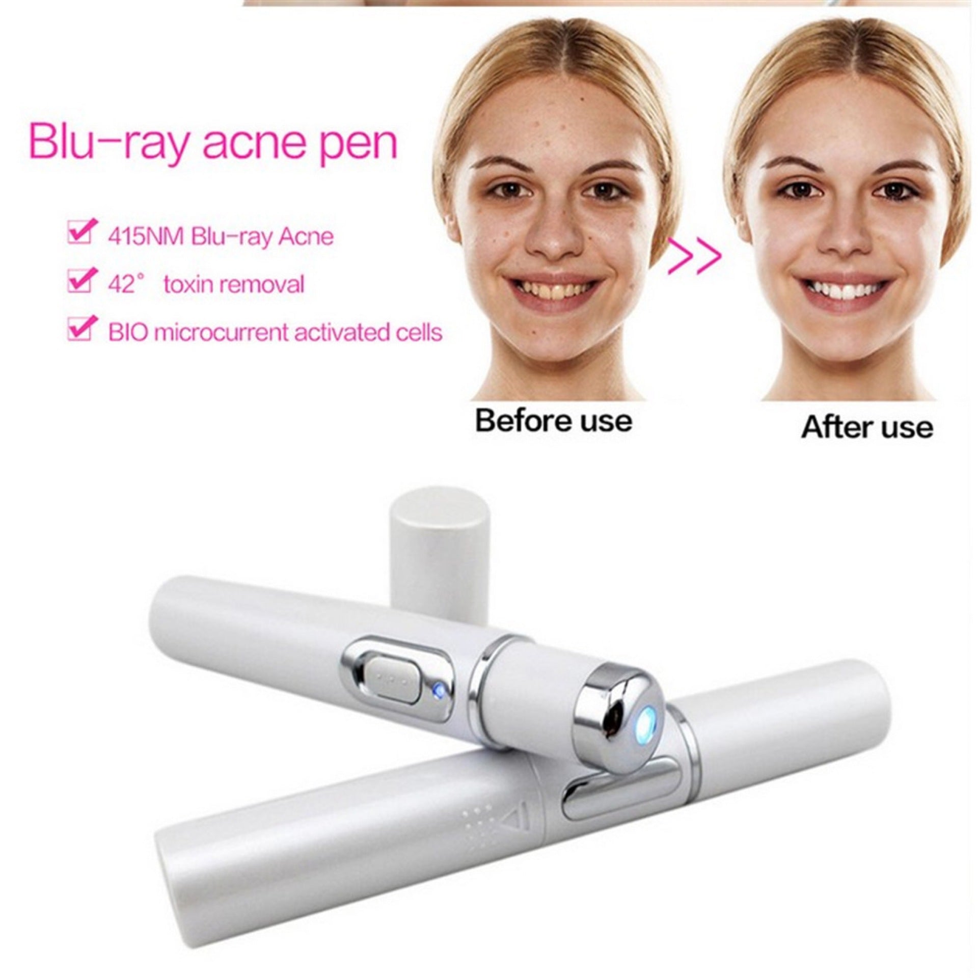Blue Light Acne & Scar Treatment Pen