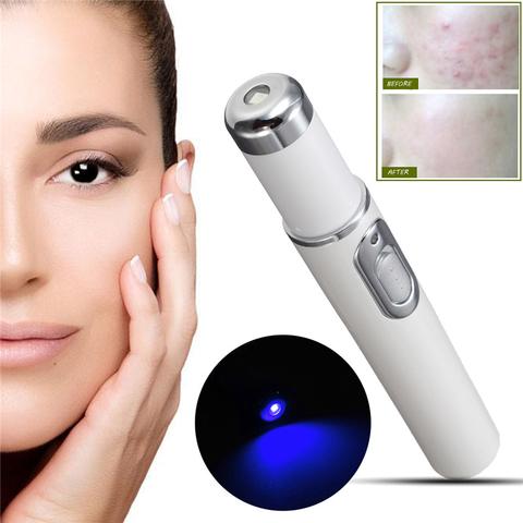 Blue Light Acne & Scar Treatment Pen