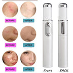 Blue Light Acne & Scar Treatment Pen
